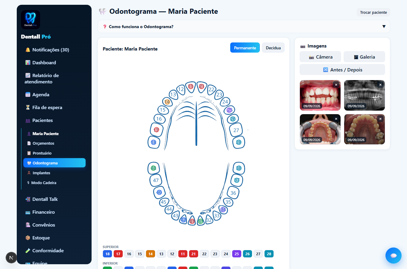 Odontograma